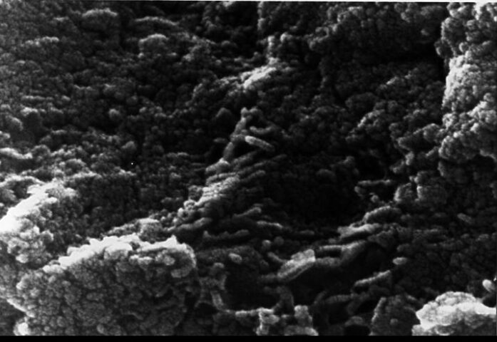 Mars Life? - Microscopic Tubular Structures